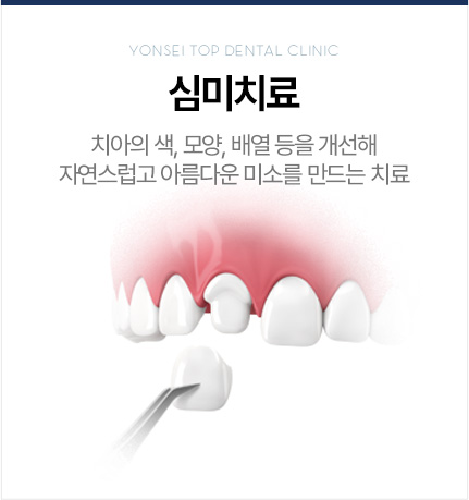 심미치료
