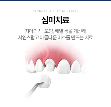 심미치료